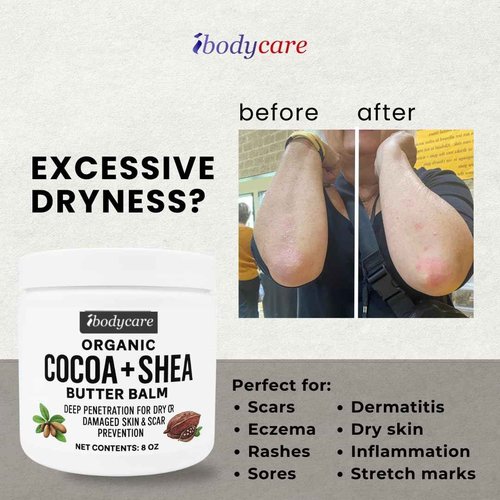 ibodycare Organic Raw Cocoa Butter Shea Butter Body Balm with Coconut Oil, 8 oz Unrefined Natural Body Butter Blend with Shea Butter Moisture for Women, Baby, Children, Men, All Body (2)