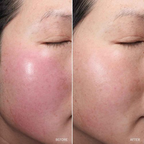 Aramore NAD+ Cell Restoration Cream, Clinically Proven Moisturizer Face Cream, Vegan, Hypoallergenic, Fragrance-Free Face Cream (50ml)