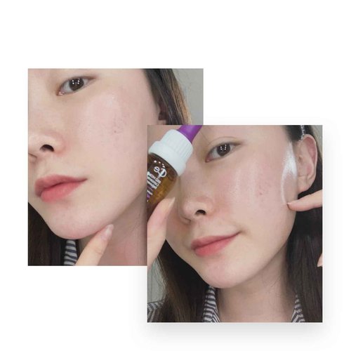 CELONIA Bio Home Solution Concentrated Skin Booster, Bio Stem Cell Ampoule, Korean Cell Growth Anti Aging Serum For Reduce Fine Line, Wrinkles & Acne Scars, Corrects Dark Spot & Reduce Redness (10ml)