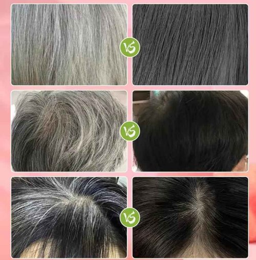 Fruit Vinegar Hair color | Ammonia Free | Gray Coverage | Non-Staining | Long-Lasting | 33.8 fl oz |1000 ml | Unisex Hair Color | Natural Black