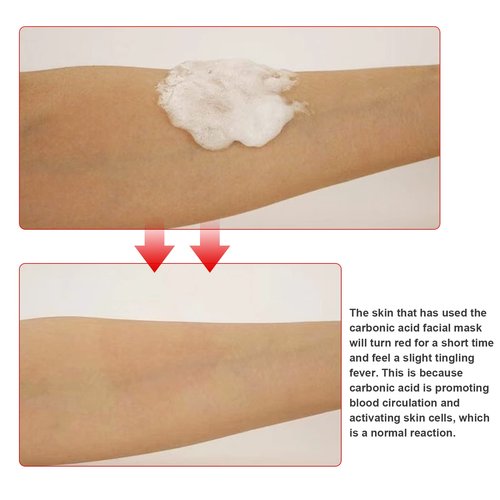 Elitzia CO2 Carboxy Gel Mask 1 box 20 bags Facial Care Skin Beauty ET1719 (Blue)