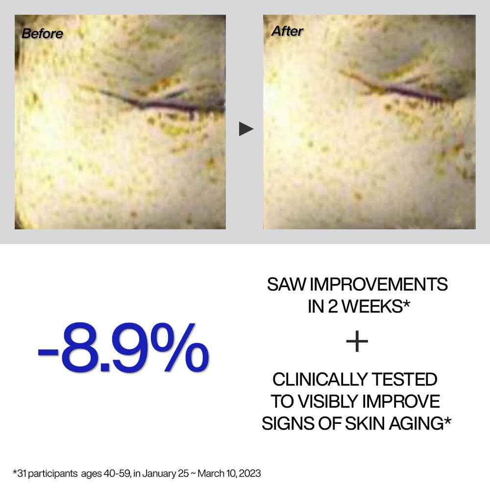 IOPE Retinol Expert 0.1% - Anti-Aging Serum with Pure Retinol, Reduce Wrinkles & Fine Lines, Pore Refining, Ideal for Retinol-Experienced User, Dermatologist Tested Korean Skincare, 1.01 fl.oz.