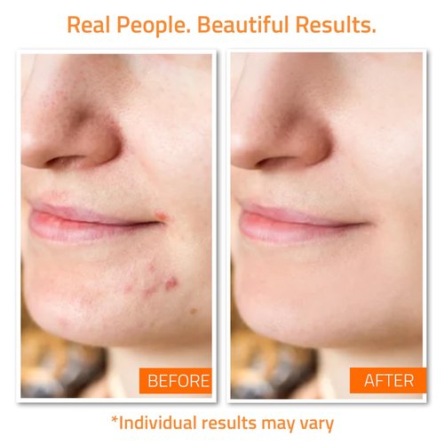 YEOUTH Skin Care Set: Vitamin C Face Wash, Toner, Vitamin C & Retinol Serum, Face Cream, Peel & Mask 7- Piece Skincare Gift Set for Teens, Women & Men