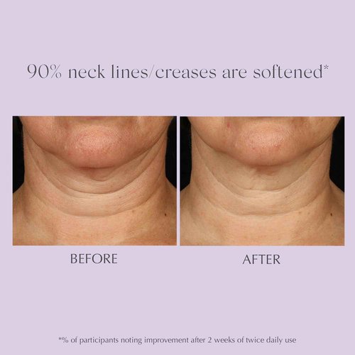 EXUVIANCE AGE REVERSE+ Toning and Firming Neck Cream, Tightens Fine Lines and Wrinkles, Evens Tone, Anti-Aging Décolletage Moisturizer with Advanced Peptide Formula, Bakuchiol, Vitamin E, 4.4 oz