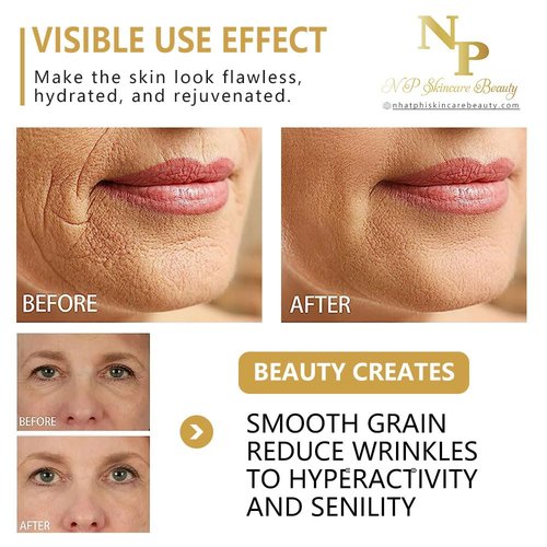 NP Skincare Instant Lift Cream with Vitamin C, Argireline, and Plant-Based Stem Cells for Moisturizing and Rejuvenated Skin - Visibly Reduces Wrinkles, Puffiness, and Dark Circles, 50 grams