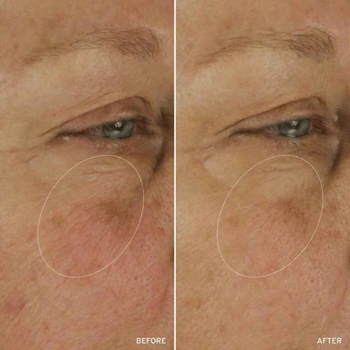 Aramore NAD+ Cell Energizing Skin Care Treatment with Proprietary NAD+ Precursor Complex, Clinically Proven to Target 12 Signs of Aging - 50ml