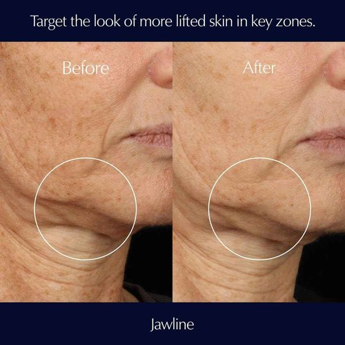 Estée Lauder Perfectionist Pro Rapid Firm + Lift Serum with Hexapeptides 8 + 9, 1 Fl Oz