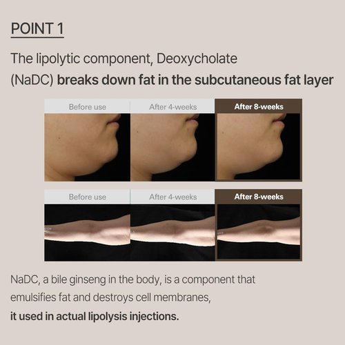 Firming & Slimming Serum for Double Chin, Jawline & Arms – Deoxycholate Contour Booster for Puffiness & Sagging Skin – Korean Face & Body Skin Care | Lalaif Slimfit Booster Serum 1.0 (50ml)