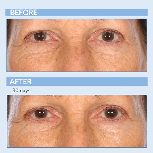 Retinol Anti-Aging Skin Care Set - Serum, Facial Moisture Cream & Face Wash - Smooth Fine Lines, Deep Wrinkles and Minimize Pores - Serious Skincare - 3 Piece Kit