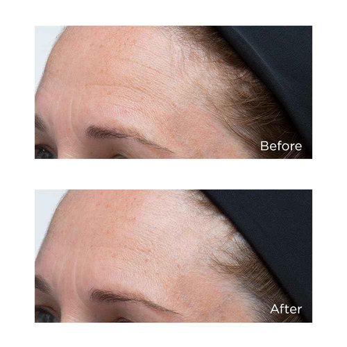 Perricone MD High Potency Classics: Hyaluronic Intensive Moisturizer 1 Fl Oz (Pack of 1)