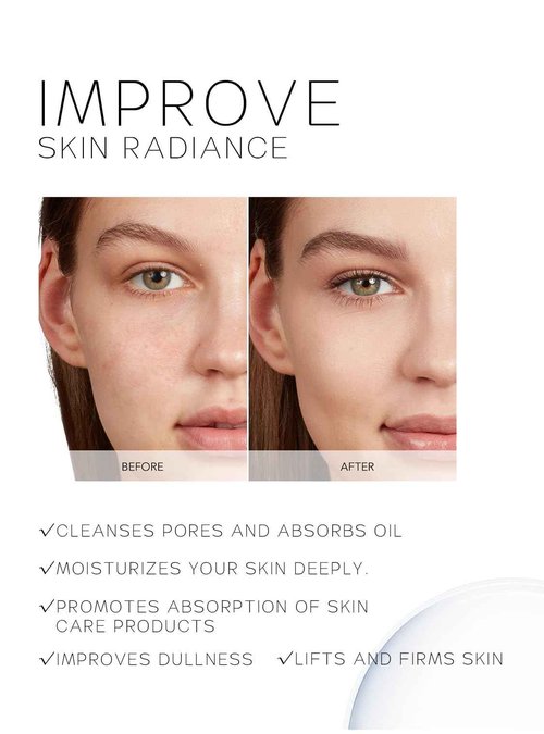kingdo 2-in-1 Microdermabrasion Machine & Blackhead Vacuum Removers with 5 Tips & 5 Suction Levels