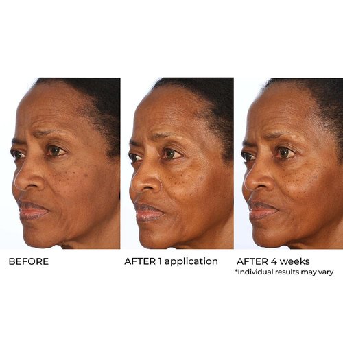 NassifMD Radiance Booster Vitamins C for Face, Brightening serum Dark Spot Remover, Vitamin C with Omega-3 and Squalene Oil