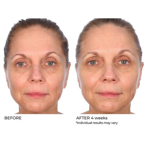 NassifMD Radiance Booster Vitamins C for Face, Brightening serum Dark Spot Remover, Vitamin C with Omega-3 and Squalene Oil