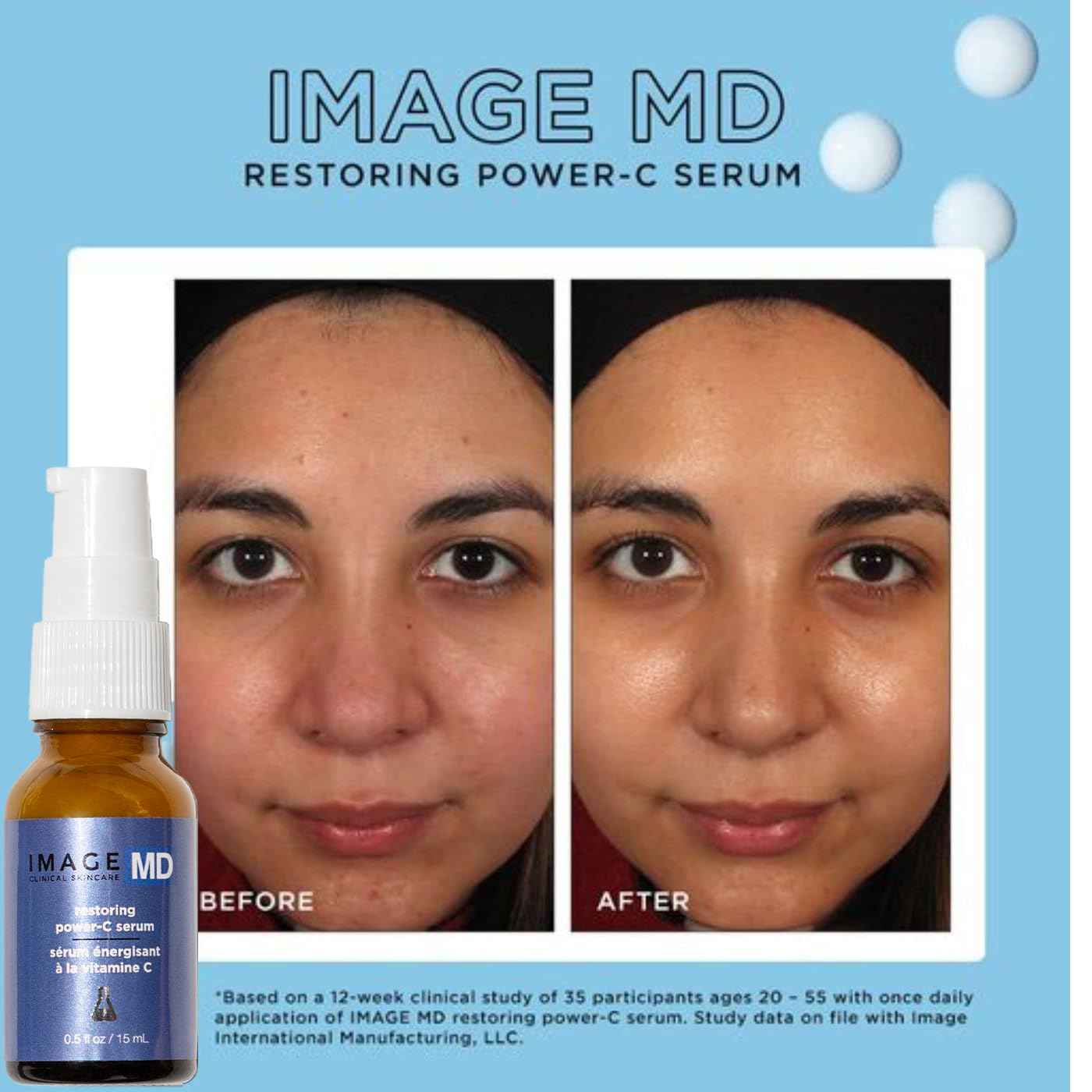 IMAGE Skincare, IMAGE MD Restoring Power-C Serum, 20% Vitamin C and Ferulic Acid Facial Serum to Reduce Pigmentation, Firm and Brighten Skin, 0.5 fl oz