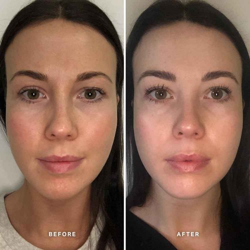 ALPHA-H | Vitamin B Serum with 5% Niacinamide