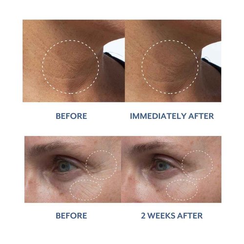 Bloomeffects - Natural Royal Tulip Moisturizing Nectar | Cruelty-Free, Non-Toxic, Clean Beauty (2.7 fl oz | 80 ml)