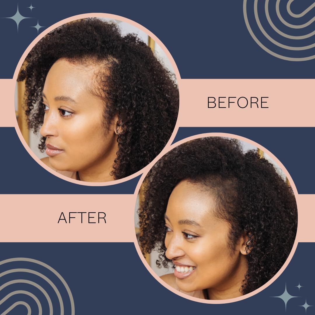 Generic ME Cosmetics AWARD WINNING CAN'T STOP ME NOW Scalp Foundation (Black Brown) | Water Proof |