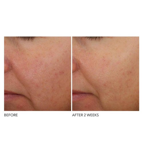 Dr Dennis Gross Advanced Retinol + Ferulic Overnight Wrinkle Treatment: Visibly Firm, Restore Hydration & Reduce the Look of Wrinkles, 1 oz