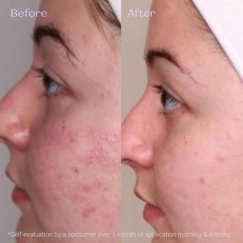 Yon-Ka Creme PG | Mattifying Protective Cream for Oily Skin | Anti-Aging Balancing Treatment for Shine and Redness | Paraben-Free | 1.68 oz