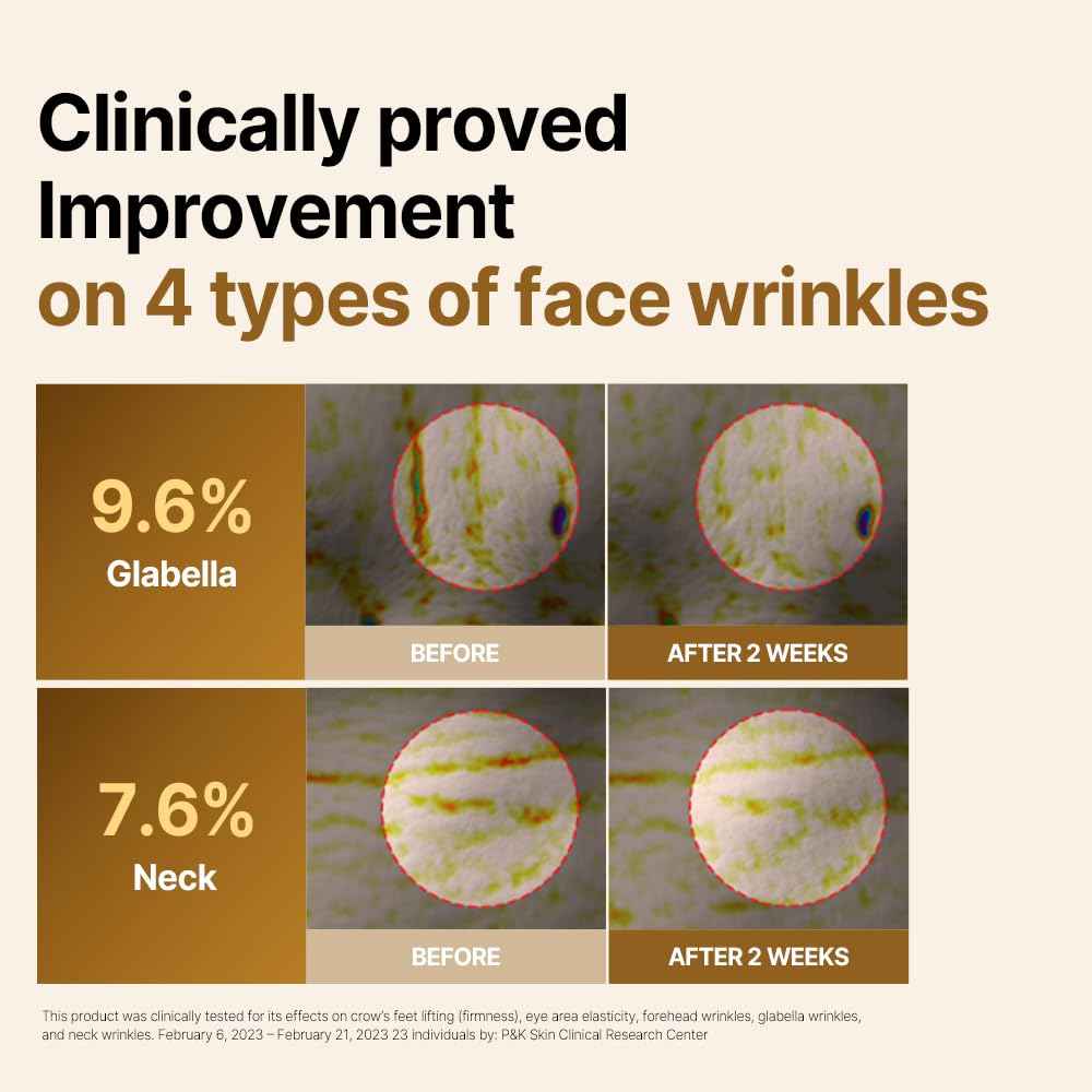 ISOI Intensive Lifting Gua Sha Ampoule Stick, Eye Roller, Under Eye Serum for Dark Circles, Puffy Bags, and Wrinkles with Bulgarian Rose Oil & Peptide Complex, Korean Skin Care (0.5 fl.oz, 15ml)