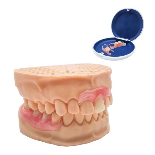 Custom Partial Dentures – Personalized Removable Denture Set for Missing Teeth | 1–6 Tooth Replacement with Storage Case | Natural Look & Comfortable Fit (1 Tooth)