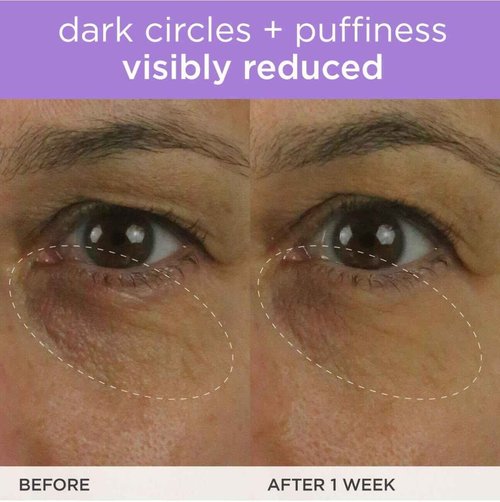 TATCHA The Brightening Eye Cream | Brightening & Dark Circle Reduction with Vitamin C for Bight, Firm Undereyes, 15 ml / 0.5 fl. oz.