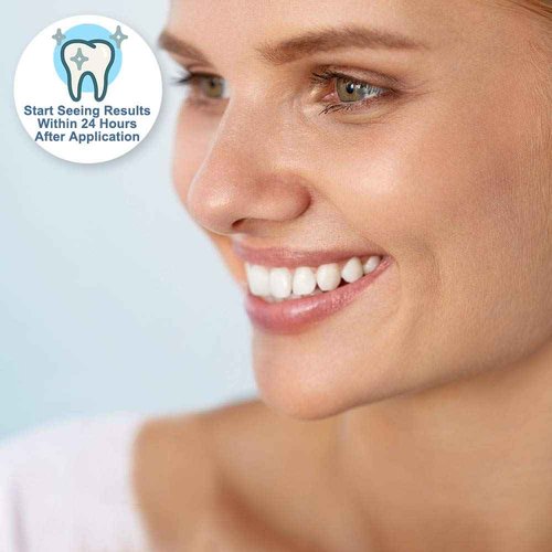 Ultra White 16% Teeth Whitening Gel Large 5 Tubes of Gel
