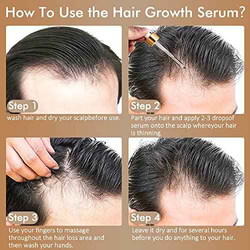 5% Minoxidil Hair Growth Serum for Men and Women, Hair Growth Serum Oil for Hair Loss for Women, Safest Hair Growth Minoxidil Treatment for Boosting Follicles, Hair Regrowth Treatments