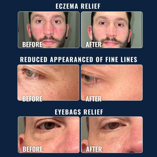 Prettyboy Face Revival Gel Moisturizer For Men - Hydrating Cream That Refreshes Dry Skin, Irritation, & Redness - Supports Anti Aging & Anti Wrinkle - Fragrance Free - 2 Count