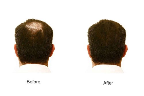 My Secret Hair Enhancer Black 5oz 3 Pack