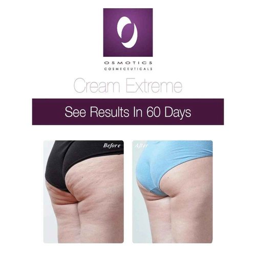 Osmotics Cream Extreme Intensive Repair – Deep Moisture Barrier Cream for Dry, Sensitive & Damaged Skin – Restores Hydration, Soothes Irritation, & Strengthens Skin Barrier