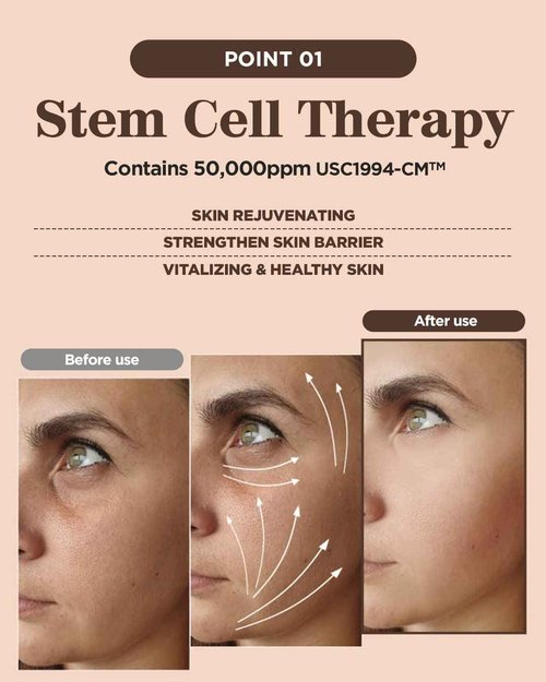 GD11 Premium Rx Cell Exosome Treatment | Premium Home Aesthetic Skin Care Set for Skin Regeneration Serum | Anti-Wrinkle and Anti-Aging Face Ampoule for Elasticity Care, 3 Pairs (0.1oz. + 0.2 fl.oz.)