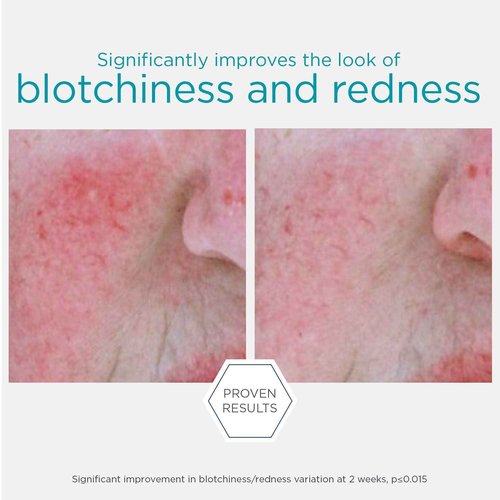 NEOSTRATA Redness Skin Neutralizing Serum Soothing, Hydrating & Cooling Concentrate For Face Oil-Free Fragrance-Free, 29 g