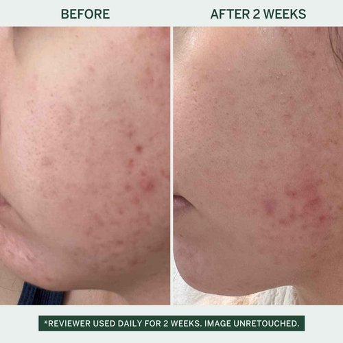 FACETORY Urban Calm Hydrating Vita Serum with Fermented Mung Bean & 10% Niacinamide, Glow Boosting Facial Serum for Women, Brightening, Fine Line & Wrinkle Treatment, Revive & Plump Skin - 30 ml