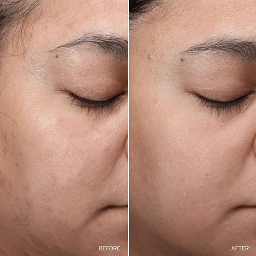 Aramore NAD+ Cell Restoration Cream, Clinically Proven Moisturizer Face Cream, Vegan, Hypoallergenic, Fragrance-Free Face Cream (50ml)