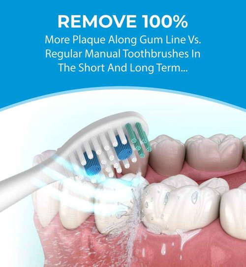 NetGen Sonic Electric Toothbrush for Adults with 5 Toothbrush Replacement Heads, 3 Brushing Modes & 2 Minutes Built-in Timer, Travel Toothbrushes with Inductive Charging, Rechargeable Toothbrush