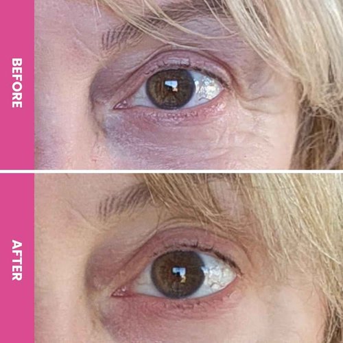 PRIME PROMETICS PrimeEyes Hydrate Under Eye Cream for Mature Women – Hydrating Eye Cream for Dark Circles and Wrinkle Repair – Soft, Glowing & Healthy Under Eyes