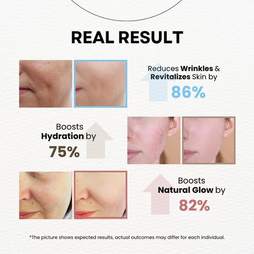 La Noubelle MPC Stem Cell Moisturizing Cream – Anti-aging, Wrinkle Care, Skin Regeneration. Firming, Deep Hydration, Face Moisturizer with Caviar, Niacinamide and Peptides, Korean Skin Care 3.38 fl oz