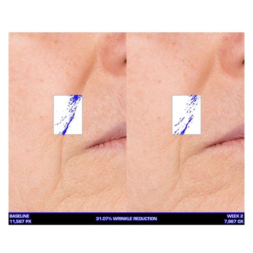 Serious Skincare Ultra-Mare Pure Marine Infusion Facial Serum - Encourages Collagen Production, Cell Turnover and Plumper Skin - Niacinamide - Acid Free - Concentrated 2 oz.