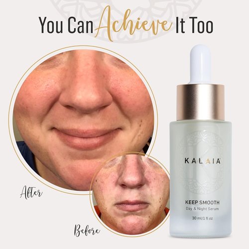 Keep Smooth Day & Night Serum | 30 mL | Hydrating Skin Care for Face, Neck & Chest | With Hyaluronic Acid, Water & Natural Ingredients for Youthful Glow and Smooth Skin