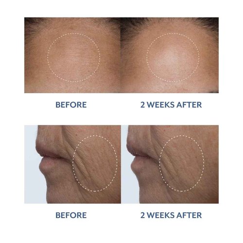 Bloomeffects - Natural Black Tulip Facial Treatment Moisturizer | Clean, Non-Toxic Skincare (1.7oz | 50mL)