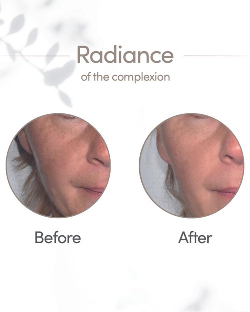 Yon-Ka Glyconight 10% Peel Masque | Anti-Aging Face Mask | Skin Renewal for Wrinkles and Pore Reduction with Glycolic Acid | 1.77 oz