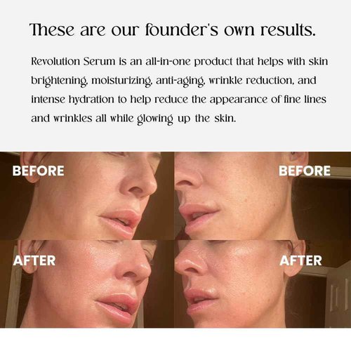 SoChérie Revolution Serum Protects From Sun Rays,Vitamin C, Hydration and Jojoba Oils, Instant Glow, Anti-Aging Power, Spot Reduction, Brightens Skin, Deep Hydration, Visible Glow