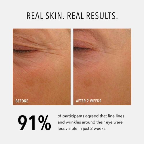 HydroPeptide Eye Authority, Brightens and Helps Restore Radiance to Tired Looking Eyes, 0.5 Ounce