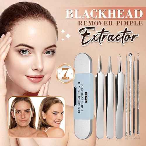 Medical Grade Blackhead Extraction Tool Kit - Blackhead Remover Tool Comedones Extractor Acne Removal Kit for Blemish - Whitehead Popping - 7 Pcs Set Removing for Nose Face Tools (Content 7-Piece Set)