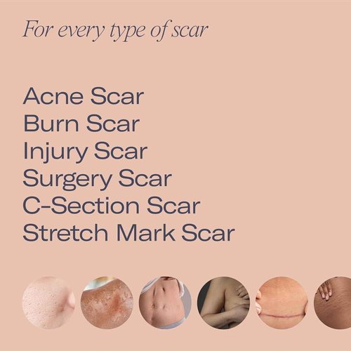 ESTAS Beauty Scar Cream -Daily Vitamin E & C with Silicone, 1 oz -Effective for Old & New Scars on Face & Body, Ideal for Surgical, Burn, C-Section & Acne Scars, Vegan + Cruelty Free, Fragrance Free