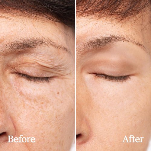 BeBebiome Revitalizing Cream (50ml / 1.7 Fl oz) Rich Texture, Skin Firning, Smoothing Fine Lines, Deep Moisturizer, Soothing, Postbiotics Skincare, NDP