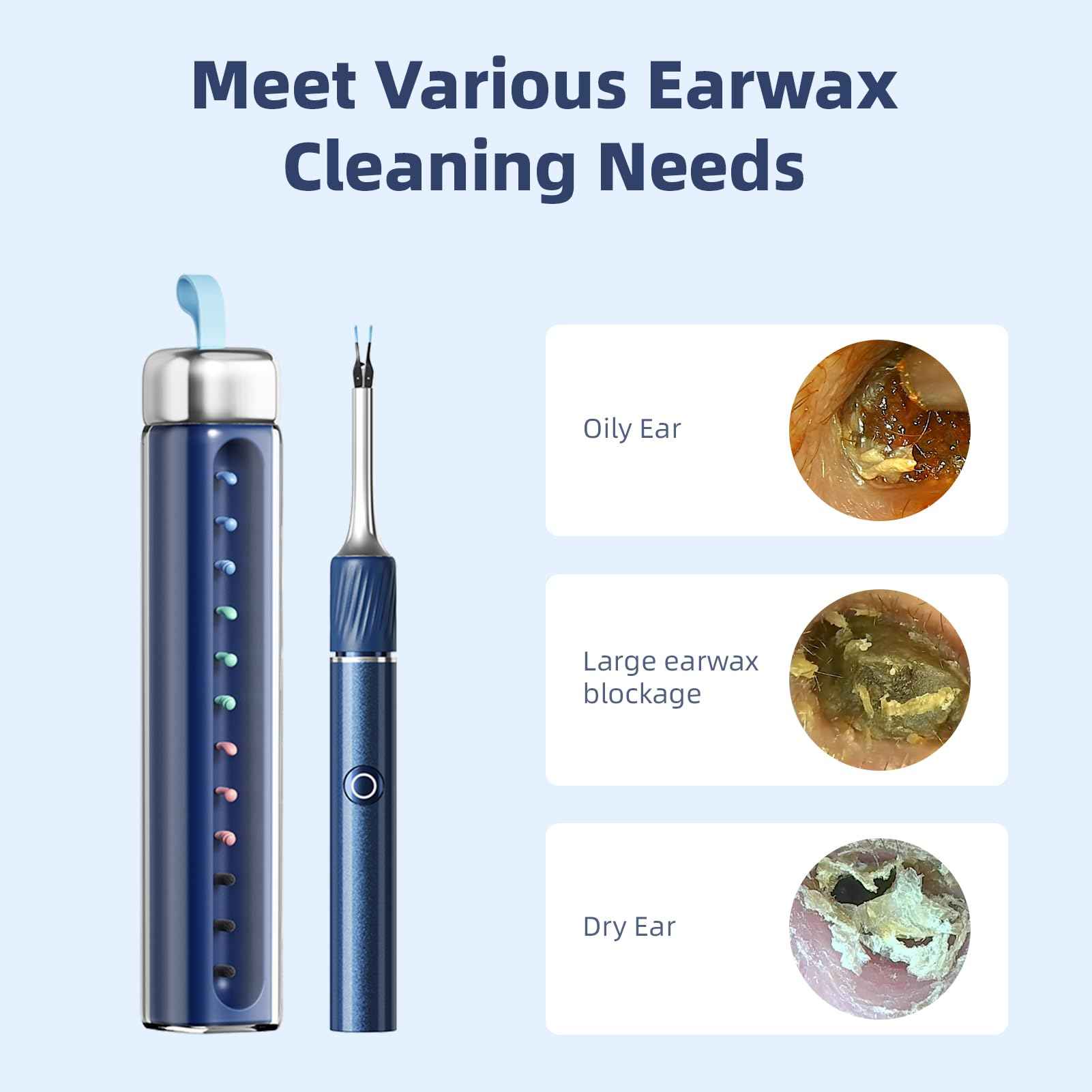 MARSDREAMS Ear Wax Removal Tool with Tweezers, Ear Cleaner with FHD Camera, Cleaning Earwax Remover Picker Kit with Light 12 Replacement Ear Picks