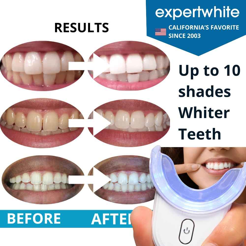 Instant Glo Teeth Whitening Kit with 32x LED Accelerator Light, Best Smile Whitener Gel Pens. Fast Results, for Sensitive Teeth, Enamel-Safe, Dentist-Trusted Incl. Mouth Tray, UV Light Whitening Kit