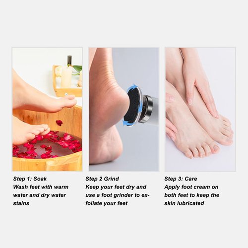 Electric Foot File, Electric Callus Remover Removable Washable Adjustable USB Interface Electric Foot Callus Remover